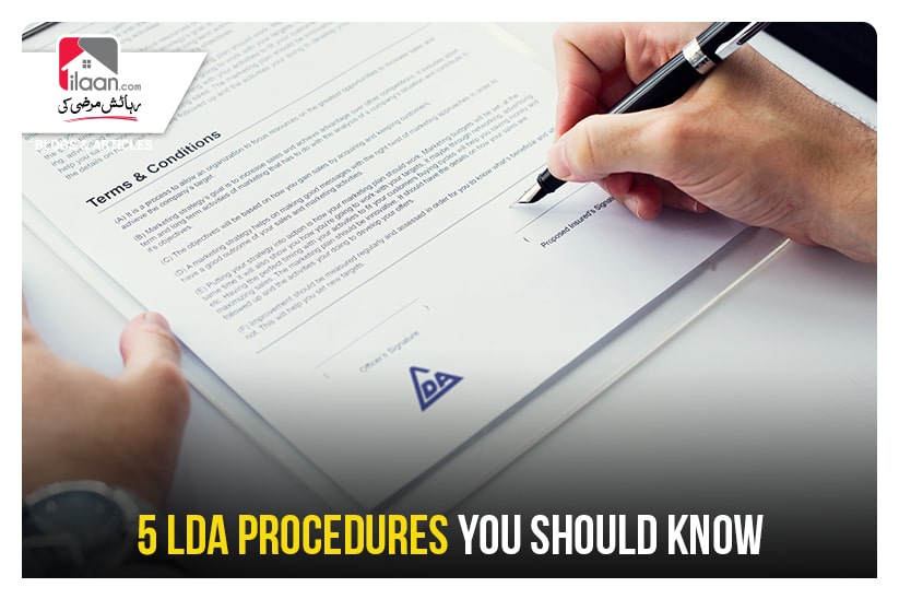 5 LDA Procedures You Should Know